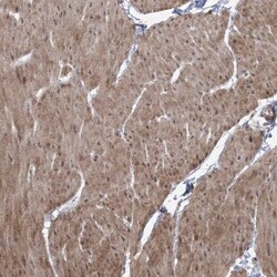 ZSCAN23 Antibody, Novus Biologicals:Antibodies:Primary Antibodies